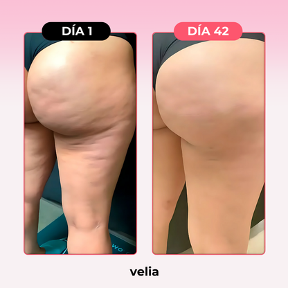 Kit Velia Pro® Elimina Celulitis y Grasa Localizada en 21 días